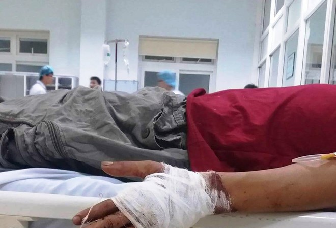 Chém gần đứt lìa bàn tay đối phương vì tranh giành khách Nạn nhân bị chém gần đứt lìa tay trái. Ảnh: Báo Lao Động