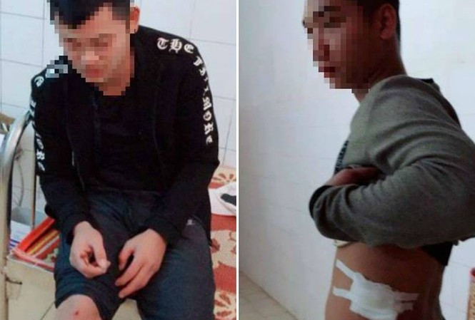 Chặn xe khách nổ súng, nhiều người bị thương Lái và phụ xe khách Tú Hùng bị côn đồ bắn trọng thương