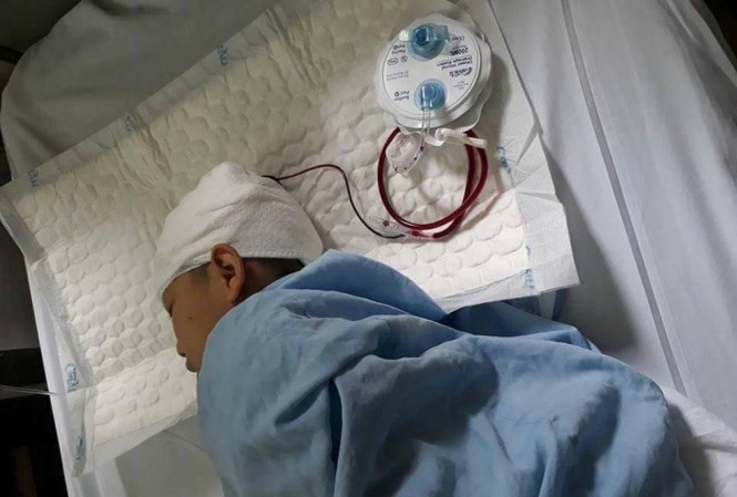 Học sinh tố thầy đánh chấn thương sọ não chỉ bị tụ máu dưới da Học sinh Cường nhập viện sau hành động của thầy giáo