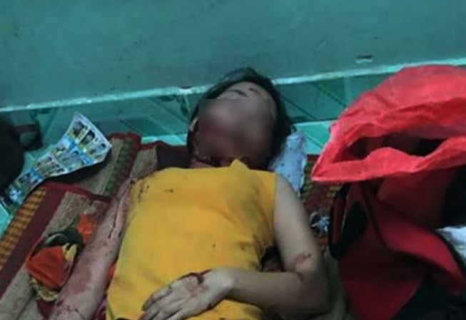 Người phụ nữ bị chém vào mặt kêu cứu trong phòng trọ Nạn nhân bị chém với vết thương trên má