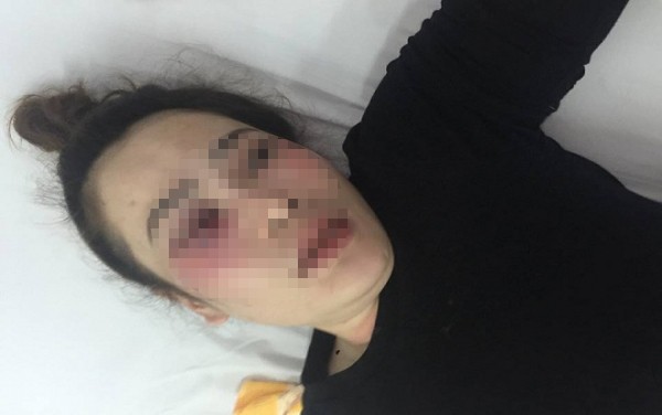 Xin lỗi phó giám đốc công an vì... gây hiểu lầm là họ hàng Chị Như đang được điều trị tại bệnh viện