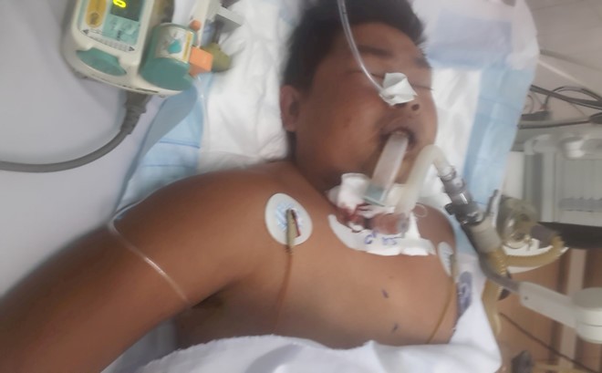 Người đàn ông bị giết vì nghi trộm chó Anh Phú được đưa đến bệnh viện cấp cứu nhưng đã tử vong ngay sau đó