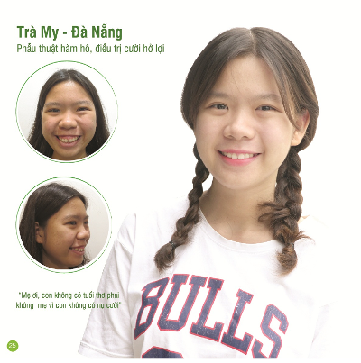 10 tỉ đồng phẫu thuật thẩm mỹ miễn phí cho người có hoàn cảnh khó khăn 10 tỉ đồng phẫu thuật thẩm mỹ miễn phí cho người có hoàn cảnh khó khăn