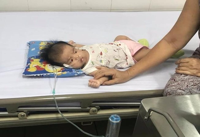 Bé 2 tháng tuổi cấp cứu vì mẹ rơ lưỡi làm sặc sữa Hiện sức khoẻ bệnh nhi đã ổn định.