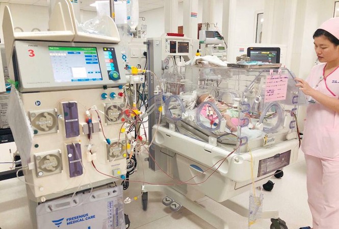 Lọc máu cứu sống bé sơ sinh nhiễm trùng huyết Lọc máu cứu sống bé sơ sinh nhiễm trùng huyết