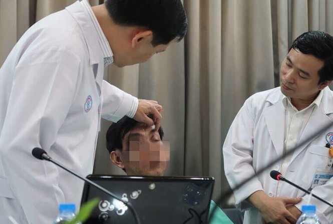 Kinh hoàng gắp hơn 10 mảnh gỗ từ hốc mắt người đàn ông Kinh hoàng gắp hơn 10 mảnh gỗ từ hốc mắt người đàn ông