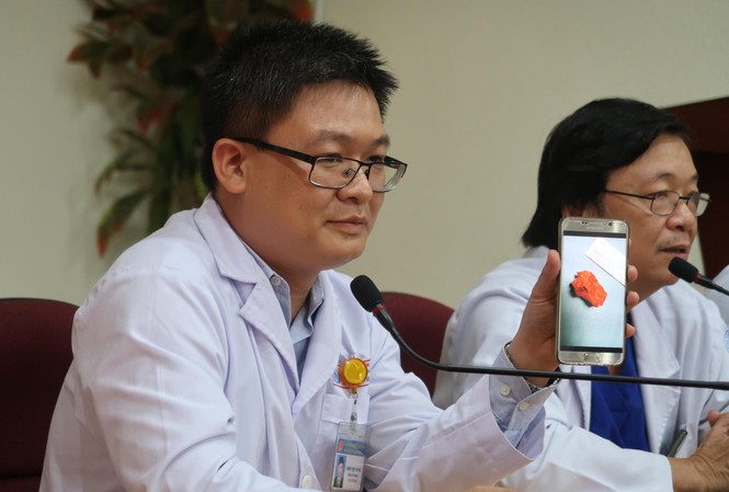 Ho kéo dài không khỏi, bé gái suýt chết vì khối bướu hiếm gặp Ho kéo dài không khỏi, bé gái suýt chết vì khối bướu hiếm gặp