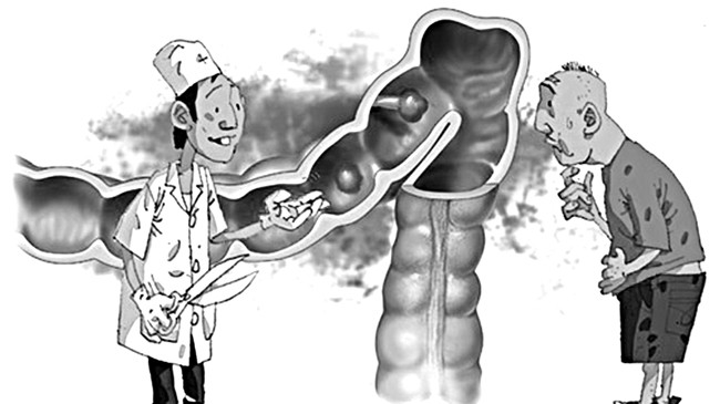Viêm đại tràng - điều trị ngay khi có dấu hiệu Viêm đại tràng - điều trị ngay khi có dấu hiệu