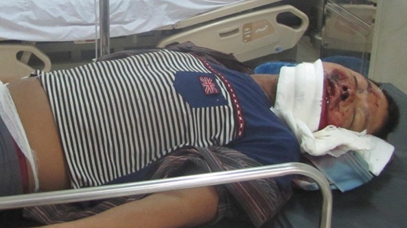 Sập giàn giáo, 5 người thương vong Những công nhân bị thương đang điều trị tại Bệnh viện Đa khoa Hà Tĩnh.