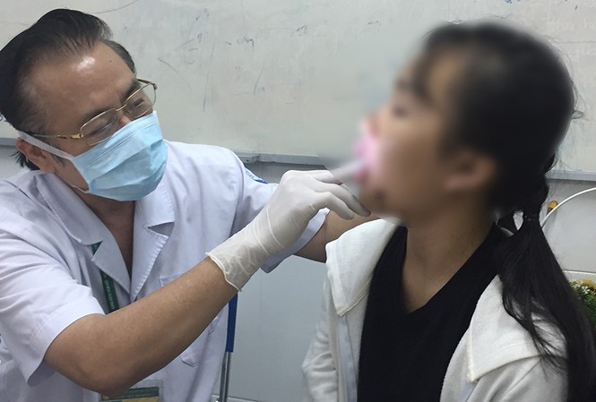 Ngã vào cửa kính ở lớp, bé gái 11 tuổi bị cứa rách mặt Bé Đ.L.P.T( 11 tuổi, ngụ Hóc Môn) đang được các bác sĩ thăm khám.