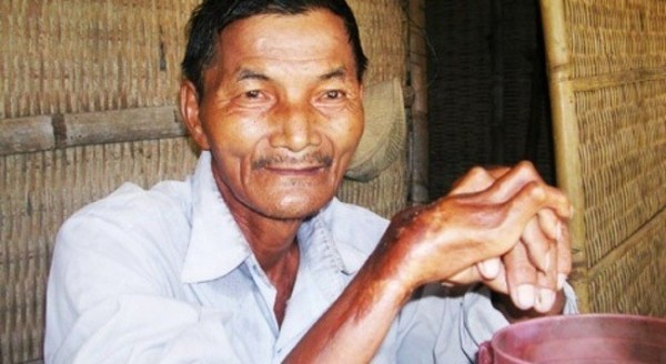Người đàn ông Việt Nam 45 năm không ngủ lọt top 10 ‘siêu nhân’ thế giới Người đàn ông Việt Nam 45 năm không ngủ lọt top 10 ‘siêu nhân’ thế giới