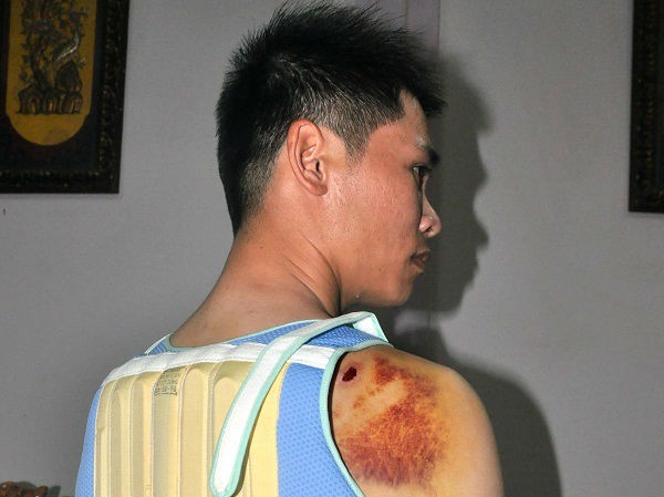 Bênh cha, con trai Bí thư xã đánh người nhập viện Anh Mậu bị con trai bí thư xã Nhân Cơ đánh