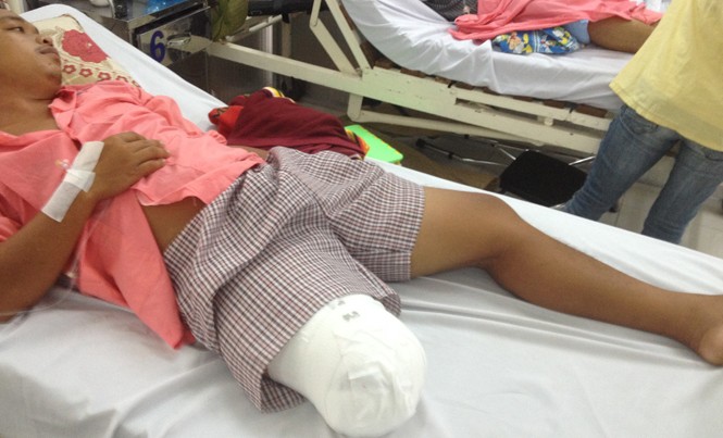Cưa chân vì bác sĩ chẩn đoán 'chấn thương phần mềm' Bệnh nhân Lê Hoàng Lâm sau khi bị cắt cụt chân.