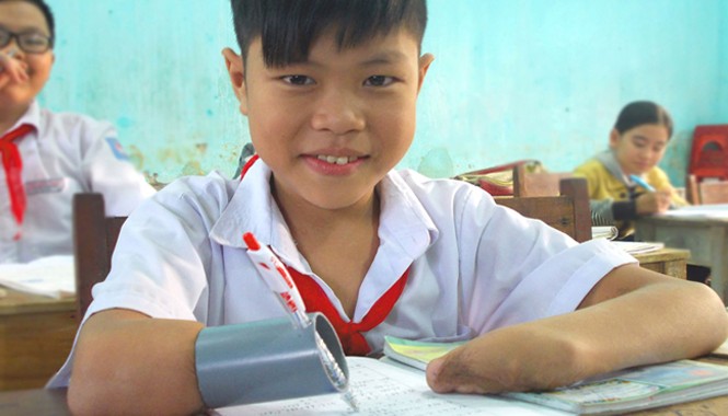 Cậu bé mất hai tay viết bài bằng… ống nhựa Phan Trọng Hiếu - cậu học trò nhỏ gan góc kiên trì với cây bút đặc biệt. Ảnh: Nguyễn Trang