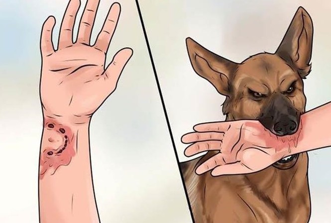 Kon Tum: 4 trường hợp tử vong do chó dại cắn Kon Tum: 4 trường hợp tử vong do chó dại cắn