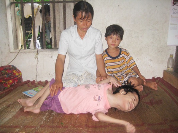 Góa chồng, nuôi con tật nguyền Chị Hương bên người con tật nguyền. Ảnh: D.Ng