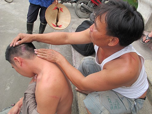 Vụ côn đồ đánh dân Tiên Lãng: Nhiều nhóm tham gia Vụ côn đồ đánh dân Tiên Lãng: Nhiều nhóm tham gia