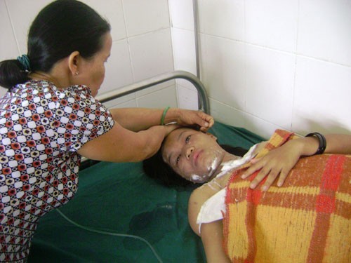 Đòi ly hôn, bị chồng ‘luộc’ vợ bằng nước sôi Đòi ly hôn, bị chồng ‘luộc’ vợ bằng nước sôi