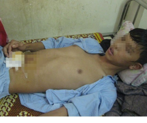 Đến thăm bạn gái, bị đâm thủng bụng Đến thăm bạn gái, bị đâm thủng bụng