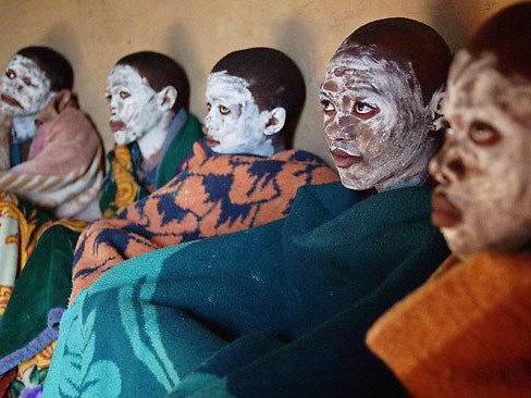 Cắt bao quy đầu, 30 người chết, 300 nhập viện Các thanh niên của bộ tộc Xhosa sau nghi lễ trưởng thành ở tỉnh Eastern Cape