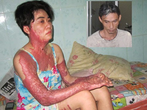 Chồng tạt xăng thiêu sống vợ Chồng tạt xăng thiêu sống vợ