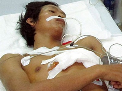 Nhậu say, múa dao tự đâm xuyên tim Nhậu say, múa dao tự đâm xuyên tim