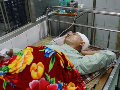 Bị đánh chấn thương sọ não vì can đánh nhau Bị đánh chấn thương sọ não vì can đánh nhau