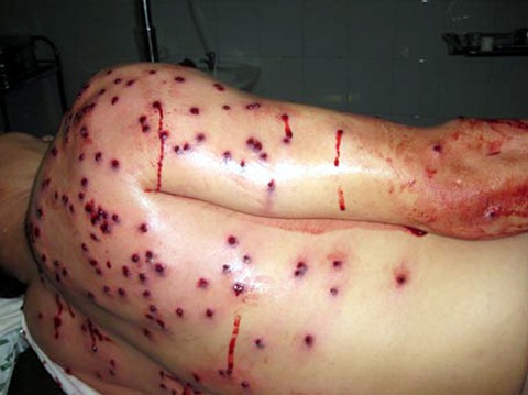 Bị bắn 100 viên đạn hoa cải vì... can đánh nhau Bị bắn 100 viên đạn hoa cải vì... can đánh nhau