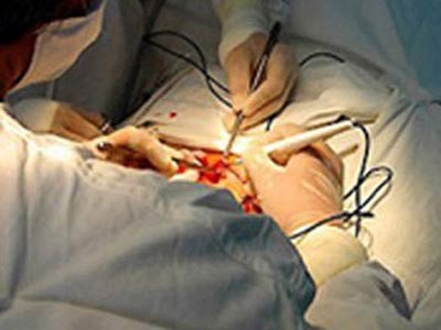 Tự bơm tăng kích cỡ 'cậu nhỏ', 40 trai làng nhập viện Tự bơm tăng kích cỡ 'cậu nhỏ', 40 trai làng nhập viện