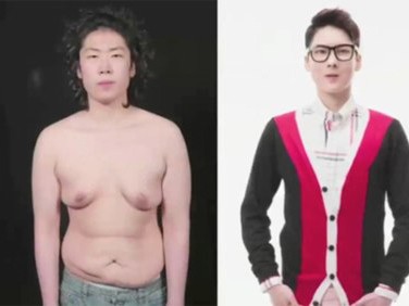Chàng trai Hàn 'lột xác' nhờ dao kéo Chàng trai Hàn 'lột xác' nhờ dao kéo