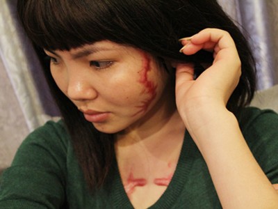 Cô gái bị xăm quái vật vào mặt và ngực nhận 400 triệu bồi thường Cô gái bị xăm quái vật vào mặt và ngực nhận 400 triệu bồi thường
