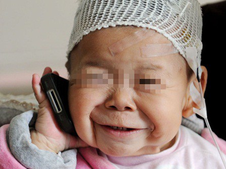 Bé gái tuổi rưỡi bỗng thành bà lão 80 Bé gái tuổi rưỡi bỗng thành bà lão 80