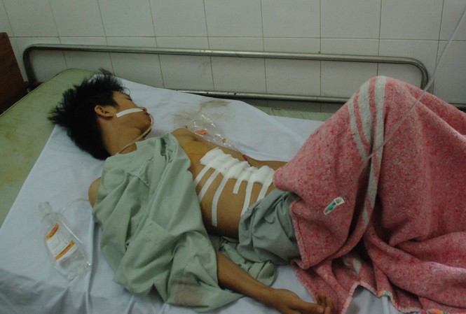Thanh niên dập lá lách sau khi làm việc với công an Thanh niên dập lá lách sau khi làm việc với công an