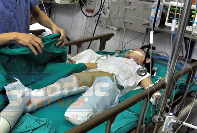 Sức khỏe cháu bé vụ nổ xe máy tiến triển tốt hơn Sức khỏe cháu bé vụ nổ xe máy tiến triển tốt hơn