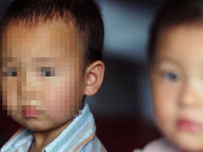 Giáo viên dùng kim châm vào vùng kín bé 3 tuổi Giáo viên dùng kim châm vào vùng kín bé 3 tuổi