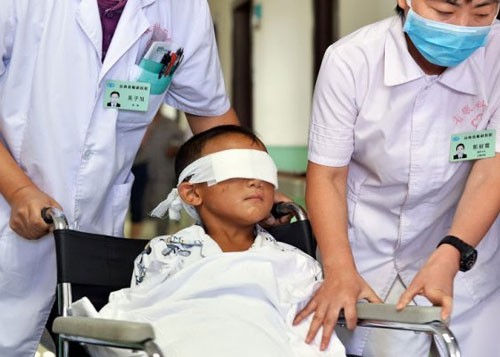 Đã lắp mắt nhân tạo cho cậu bé bị móc mắt Đã lắp mắt nhân tạo cho cậu bé bị móc mắt