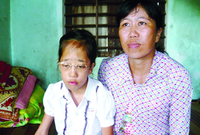 Lời nguyện nhói lòng Hai mẹ con em Thảo cùng mơ về một phép mầu giúp đôi mắt em bình thường trở lại