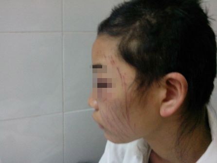 Mẹ trẻ bị hành hạ dã man vì một tin nhắn tình cảm? Mẹ trẻ bị hành hạ dã man vì một tin nhắn tình cảm?