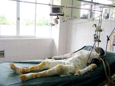 Ba người tử vong trong vụ cháu thiêu sống 11 người Ba người tử vong trong vụ cháu thiêu sống 11 người