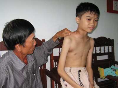 Học sinh bị bệnh hiểm nghèo cần giúp đỡ Học sinh bị bệnh hiểm nghèo cần giúp đỡ