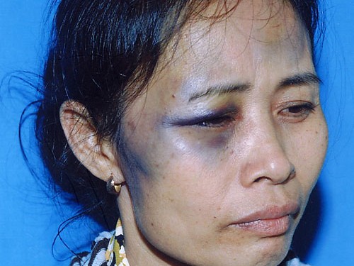 Nhân viên xe buýt lại đánh hành khách Nhân viên xe buýt lại đánh hành khách