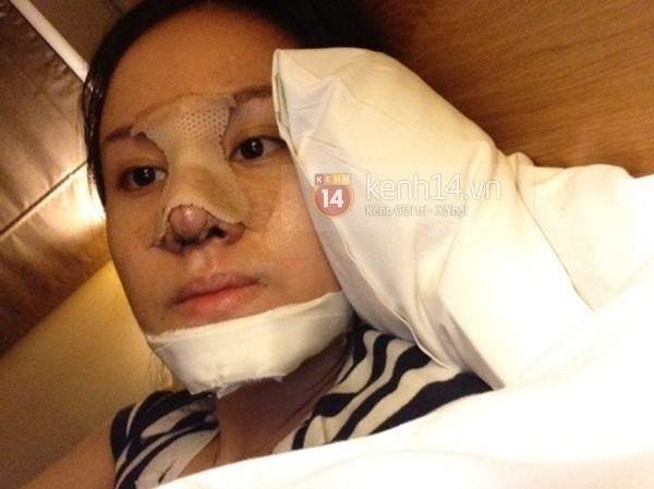 Bà Tưng lộ ảnh hậu dao kéo Bà Tưng lộ ảnh hậu dao kéo