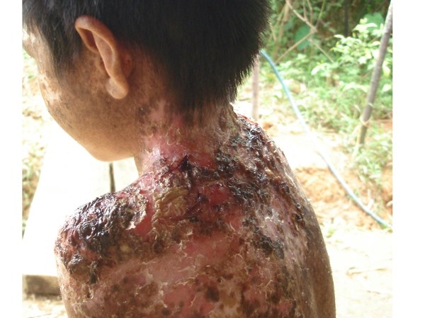 Cuộc sống cơ cực của những người bị 'quỷ ám' Cuộc sống cơ cực của những người bị 'quỷ ám'