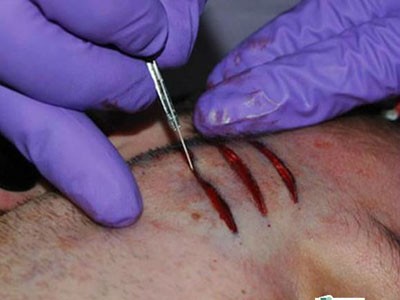 Dân chơi và thú lột da xăm sẹo kỳ quái Dân chơi và thú lột da xăm sẹo kỳ quái