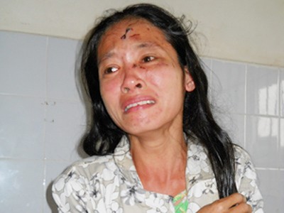 Bị anh và chị dâu hành hung vì dám... đòi nợ Bị anh và chị dâu hành hung vì dám... đòi nợ