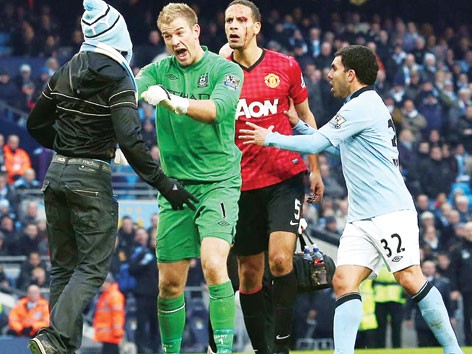 Derby thành Manchester: Đừng biến thể thao thành hận thù Derby thành Manchester: Đừng biến thể thao thành hận thù