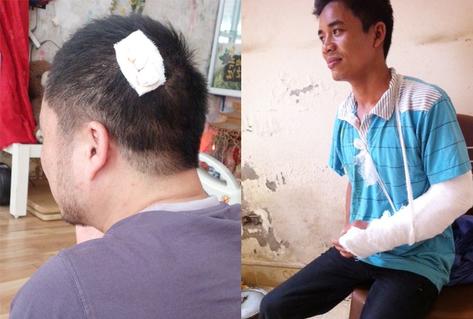Ngang nhiên vào công trường liên tục đánh người Ông Đàm Văn Long - Chủ tịch HĐQT Công ty Tập đoàn Phương Bắc và lái máy Nguyễn Trung Thành với thương tích trên người. Ảnh: TN