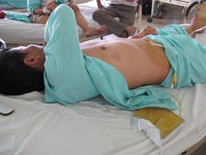 Vợ bạo hành chồng: Đòn độc của “phái yếu” Vợ bạo hành chồng: Đòn độc của “phái yếu”