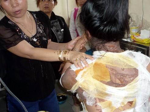 Chưa ngăn chặn người chồng tạt nước sôi vợ Chưa ngăn chặn người chồng tạt nước sôi vợ