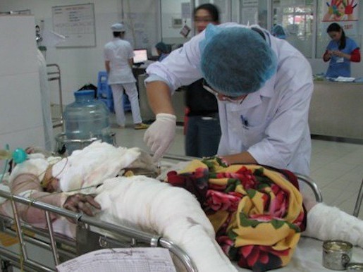 Cô gái bị thiêu sống đang nguy kịch Cô gái bị thiêu sống đang nguy kịch